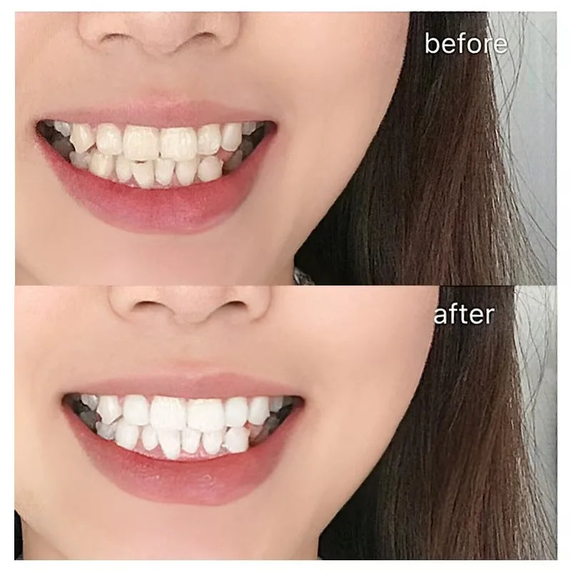 Whitening Strips, 7-day treatment (7 Packets - 2 Strips per pack)- Enamel-Safe Strips for Sensitive Teeth - Non-Slip, Dry Strip